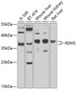 Western blot analysis of extracts of various cell lines, using RDH5 antibody (23-369) at 1:1000 dilution.<br/>Secondary antibody: HRP Goat Anti-Rabbit IgG (H+L) at 1:10000 dilution.<br/>Lysates/proteins: 25ug per lane.<br/>Blocking buffer: 3% nonfat dry milk in TBST.<br/>Detection: ECL Enhanced Kit.<br/>Exposure time: 90s.