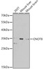 Western blot analysis of extracts of various cell lines, using CNOT8 antibody (23-371) at 1:1000 dilution.<br/>Secondary antibody: HRP Goat Anti-Rabbit IgG (H+L) at 1:10000 dilution.<br/>Lysates/proteins: 25ug per lane.<br/>Blocking buffer: 3% nonfat dry milk in TBST.<br/>Detection: ECL Basic Kit.<br/>Exposure time: 90s.