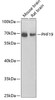 Western blot analysis of extracts of various cell lines, using PHF19 antibody (23-376) at 1:1000 dilution.<br/>Secondary antibody: HRP Goat Anti-Rabbit IgG (H+L) at 1:10000 dilution.<br/>Lysates/proteins: 25ug per lane.<br/>Blocking buffer: 3% nonfat dry milk in TBST.<br/>Detection: ECL Basic Kit.<br/>Exposure time: 90s.