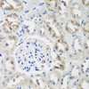 Immunohistochemistry of paraffin-embedded rat kidney using NEDD4L antibody (23-389) at dilution of 1:200 (40x lens) .