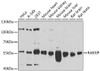 Western blot analysis of extracts of various cell lines, using RAB3IP antibody (23-396) at 1:1000 dilution.<br/>Secondary antibody: HRP Goat Anti-Rabbit IgG (H+L) at 1:10000 dilution.<br/>Lysates/proteins: 25ug per lane.<br/>Blocking buffer: 3% nonfat dry milk in TBST.<br/>Detection: ECL Basic Kit.<br/>Exposure time: 30s.