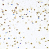 Immunohistochemistry of paraffin-embedded mouse brain using RAB3IP antibody (23-396) at dilution of 1:100 (40x lens) .