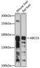 Western blot analysis of extracts of various cell lines, using ABCC6 antibody (23-399) at 1:1000 dilution.<br/>Secondary antibody: HRP Goat Anti-Rabbit IgG (H+L) at 1:10000 dilution.<br/>Lysates/proteins: 25ug per lane.<br/>Blocking buffer: 3% nonfat dry milk in TBST.<br/>Detection: ECL Basic Kit.<br/>Exposure time: 30s.