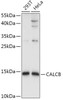 Western blot analysis of extracts of various cell lines, using CALCB antibody (23-403) at 1:1000 dilution.<br/>Secondary antibody: HRP Goat Anti-Rabbit IgG (H+L) at 1:10000 dilution.<br/>Lysates/proteins: 25ug per lane.<br/>Blocking buffer: 3% nonfat dry milk in TBST.<br/>Detection: ECL Basic Kit.<br/>Exposure time: 5s.