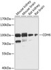Western blot analysis of extracts of various cell lines, using CDH6 antibody (23-406) at 1:1000 dilution.<br/>Secondary antibody: HRP Goat Anti-Rabbit IgG (H+L) at 1:10000 dilution.<br/>Lysates/proteins: 25ug per lane.<br/>Blocking buffer: 3% nonfat dry milk in TBST.<br/>Detection: ECL Basic Kit.<br/>Exposure time: 90s.