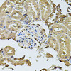 Immunohistochemistry of paraffin-embedded rat kidney using CDH6 antibody (23-406) at dilution of 1:100 (40x lens) .