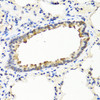 Immunohistochemistry of paraffin-embedded rat lung using IFNW1 antibody (23-417) at dilution of 1:100 (40x lens) .