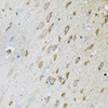 Immunohistochemistry of paraffin-embedded rat brain using MT-ND5 antibody (23-423) at dilution of 1:100 (40x lens) .