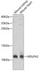 Western blot analysis of extracts of various cell lines, using NDUFA2 antibody (23-424) at 1:1000 dilution.<br/>Secondary antibody: HRP Goat Anti-Rabbit IgG (H+L) at 1:10000 dilution.<br/>Lysates/proteins: 25ug per lane.<br/>Blocking buffer: 3% nonfat dry milk in TBST.<br/>Detection: ECL Basic Kit.<br/>Exposure time: 30s.