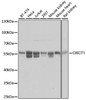 Western blot analysis of extracts of various cell lines, using OXCT1 antibody (23-426) at 1:3000 dilution.<br/>Secondary antibody: HRP Goat Anti-Rabbit IgG (H+L) at 1:10000 dilution.<br/>Lysates/proteins: 25ug per lane.<br/>Blocking buffer: 3% nonfat dry milk in TBST.<br/>Detection: ECL Basic Kit.<br/>Exposure time: 1s.