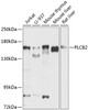 Western blot analysis of extracts of various cell lines, using PLCB2 antibody (23-428) at 1:1000 dilution.<br/>Secondary antibody: HRP Goat Anti-Rabbit IgG (H+L) at 1:10000 dilution.<br/>Lysates/proteins: 25ug per lane.<br/>Blocking buffer: 3% nonfat dry milk in TBST.<br/>Detection: ECL Basic Kit.<br/>Exposure time: 30s.