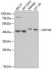 Western blot analysis of extracts of various cell lines, using NPY4R antibody (23-430) at 1:1000 dilution.<br/>Secondary antibody: HRP Goat Anti-Rabbit IgG (H+L) at 1:10000 dilution.<br/>Lysates/proteins: 25ug per lane.<br/>Blocking buffer: 3% nonfat dry milk in TBST.<br/>Detection: ECL Basic Kit.<br/>Exposure time: 1s.