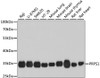 Western blot analysis of extracts of various cell lines, using PRPS1 antibody (23-431) at 1:1000 dilution.<br/>Secondary antibody: HRP Goat Anti-Rabbit IgG (H+L) at 1:10000 dilution.<br/>Lysates/proteins: 25ug per lane.<br/>Blocking buffer: 3% nonfat dry milk in TBST.<br/>Detection: ECL Basic Kit.<br/>Exposure time: 40s.