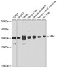 Western blot analysis of extracts of various cell lines, using SRM antibody (23-435) at 1:1000 dilution.<br/>Secondary antibody: HRP Goat Anti-Rabbit IgG (H+L) at 1:10000 dilution.<br/>Lysates/proteins: 25ug per lane.<br/>Blocking buffer: 3% nonfat dry milk in TBST.<br/>Detection: ECL Basic Kit.<br/>Exposure time: 10s.