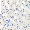 Immunohistochemistry of paraffin-embedded mouse kidney using THOC1 antibody (23-447) at dilution of 1:100 (40x lens) .