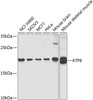 Western blot analysis of extracts of various cell lines, using ATP6 antibody (23-453) at 1:1000 dilution._Secondary antibody: HRP Goat Anti-Rabbit IgG (H+L) at 1:10000 dilution._Lysates/proteins: 25ug per lane._Blocking buffer: 3% nonfat dry milk in TBST._Detection: ECL Enhanced Kit._Exposure time: 10s.