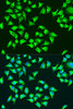 Immunofluorescence analysis of U2OS cells using ATP6 antibody (23-453) at dilution of 1:100. Blue: DAPI for nuclear staining.