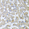Immunohistochemistry of paraffin-embedded human liver damage using TTLL12 antibody (23-455) at dilution of 1:100 (40x lens) .