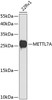 Western blot analysis of extracts of 22Rv1 cells, using METTL7A antibody (23-458) at 1:1000 dilution.<br/>Secondary antibody: HRP Goat Anti-Rabbit IgG (H+L) at 1:10000 dilution.<br/>Lysates/proteins: 25ug per lane.<br/>Blocking buffer: 3% nonfat dry milk in TBST.<br/>Detection: ECL Basic Kit.<br/>Exposure time: 90s.