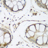 Immunohistochemistry of paraffin-embedded human gastric using TAZ antibody (23-459) at dilution of 1:200 (40x lens) .