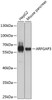 Western blot analysis of extracts of various cell lines, using ARFGAP3 antibody (23-461) at 1:1000 dilution.<br/>Secondary antibody: HRP Goat Anti-Rabbit IgG (H+L) at 1:10000 dilution.<br/>Lysates/proteins: 25ug per lane.<br/>Blocking buffer: 3% nonfat dry milk in TBST.<br/>Detection: ECL Basic Kit.<br/>Exposure time: 30s.