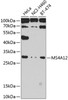 Western blot analysis of extracts of various cell lines, using MS4A12 antibody (23-468) at 1:1000 dilution.<br/>Secondary antibody: HRP Goat Anti-Rabbit IgG (H+L) at 1:10000 dilution.<br/>Lysates/proteins: 25ug per lane.<br/>Blocking buffer: 3% nonfat dry milk in TBST.<br/>Detection: ECL Basic Kit.<br/>Exposure time: 90s.