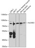 Western blot analysis of extracts of various cell lines, using ALOXE3 antibody (23-475) at 1:1000 dilution.<br/>Secondary antibody: HRP Goat Anti-Rabbit IgG (H+L) at 1:10000 dilution.<br/>Lysates/proteins: 25ug per lane.<br/>Blocking buffer: 3% nonfat dry milk in TBST.<br/>Detection: ECL Basic Kit.<br/>Exposure time: 60s.