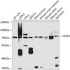 Western blot analysis of extracts of various cell lines, using HPSE2 antibody (23-476) at 1:1000 dilution.<br/>Secondary antibody: HRP Goat Anti-Rabbit IgG (H+L) at 1:10000 dilution.<br/>Lysates/proteins: 25ug per lane.<br/>Blocking buffer: 3% nonfat dry milk in TBST.<br/>Detection: ECL Basic Kit.<br/>Exposure time: 90s.