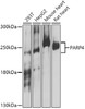 Western blot analysis of extracts of various cell lines, using PARP4 antibody (23-520) at 1:1000 dilution.<br/>Secondary antibody: HRP Goat Anti-Rabbit IgG (H+L) at 1:10000 dilution.<br/>Lysates/proteins: 25ug per lane.<br/>Blocking buffer: 3% nonfat dry milk in TBST.<br/>Detection: ECL Basic Kit.<br/>Exposure time: 5s.