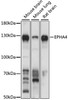Western blot analysis of extracts of various cell lines, using EPHA4 antibody (23-522) at 1:1000 dilution.<br/>Secondary antibody: HRP Goat Anti-Rabbit IgG (H+L) at 1:10000 dilution.<br/>Lysates/proteins: 25ug per lane.<br/>Blocking buffer: 3% nonfat dry milk in TBST.<br/>Detection: ECL Basic Kit.<br/>Exposure time: 3s.