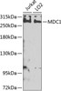 Western blot analysis of extracts of various cell lines, using MDC1 antibody (23-531) at 1:1000 dilution._Secondary antibody: HRP Goat Anti-Rabbit IgG (H+L) at 1:10000 dilution._Lysates/proteins: 25ug per lane._Blocking buffer: 3% nonfat dry milk in TBST._Detection: ECL Enhanced Kit._Exposure time: 5s.