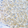 Immunohistochemistry of paraffin-embedded human liver using UBE2U antibody (23-541) at dilution of 1:100 (40x lens) .