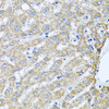 Immunohistochemistry of paraffin-embedded human liver using TMEM189 antibody (23-544) at dilution of 1:100 (40x lens) .