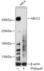 Western blot analysis of extracts of HeLa cells, using ABCC2 antibody (23-561) at 1:1000 dilution.<br/>Secondary antibody: HRP Goat Anti-Rabbit IgG (H+L) at 1:10000 dilution.<br/>Lysates/proteins: 25ug per lane.<br/>Blocking buffer: 3% nonfat dry milk in TBST.<br/>Detection: ECL Basic Kit.<br/>Exposure time: 60s.