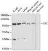 Western blot analysis of extracts of various cell lines, using CR2 antibody (23-562) at 1:1000 dilution.<br/>Secondary antibody: HRP Goat Anti-Rabbit IgG (H+L) at 1:10000 dilution.<br/>Lysates/proteins: 25ug per lane.<br/>Blocking buffer: 3% nonfat dry milk in TBST.<br/>Detection: ECL Basic Kit.<br/>Exposure time: 15s.