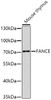 Western blot analysis of extracts of mouse thymus, using FANCE antibody (23-568) at 1:1000 dilution.<br/>Secondary antibody: HRP Goat Anti-Rabbit IgG (H+L) at 1:10000 dilution.<br/>Lysates/proteins: 25ug per lane.<br/>Blocking buffer: 3% nonfat dry milk in TBST.<br/>Detection: ECL Basic Kit.<br/>Exposure time: 10s.