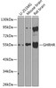 Western blot analysis of extracts of various cell lines, using GHRHR antibody (23-571) at 1:1000 dilution.<br/>Secondary antibody: HRP Goat Anti-Rabbit IgG (H+L) at 1:10000 dilution.<br/>Lysates/proteins: 25ug per lane.<br/>Blocking buffer: 3% nonfat dry milk in TBST.<br/>Detection: ECL Enhanced Kit.<br/>Exposure time: 15s.
