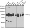 Western blot analysis of extracts of various cell lines, using HNRNPL antibody (23-578) at 1:1000 dilution.<br/>Secondary antibody: HRP Goat Anti-Rabbit IgG (H+L) at 1:10000 dilution.<br/>Lysates/proteins: 25ug per lane.<br/>Blocking buffer: 3% nonfat dry milk in TBST.<br/>Detection: ECL Enhanced Kit.<br/>Exposure time: 60s.