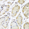 Immunohistochemistry of paraffin-embedded human stomach using HNRNPL antibody (23-578) at dilution of 1:100 (40x lens) .