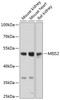 Western blot analysis of extracts of various cell lines, using MEIS2 antibody (23-583) at 1:1000 dilution.<br/>Secondary antibody: HRP Goat Anti-Rabbit IgG (H+L) at 1:10000 dilution.<br/>Lysates/proteins: 25ug per lane.<br/>Blocking buffer: 3% nonfat dry milk in TBST.<br/>Detection: ECL Basic Kit.<br/>Exposure time: 10s.