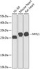 Western blot analysis of extracts of various cell lines, using MYL1 antibody (23-584) at 1:1000 dilution.<br/>Secondary antibody: HRP Goat Anti-Rabbit IgG (H+L) at 1:10000 dilution.<br/>Lysates/proteins: 25ug per lane.<br/>Blocking buffer: 3% nonfat dry milk in TBST.<br/>Detection: ECL Basic Kit.<br/>Exposure time: 60s.