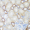 Immunohistochemistry of paraffin-embedded mouse kidney using NEFH antibody (23-587) at dilution of 1:100 (40x lens) .
