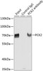 Immunoprecipitation analysis of extracts of HepG2 cells using PCK2 antibody (23-590) . Western blot was performed from the immunoprecipitate using PCK2 antibody (23-590) at a dilition of 1:1000.