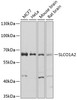 Western blot analysis of extracts of various cell lines, using SLCO1A2 antibody (23-594) at 1:1000 dilution.<br/>Secondary antibody: HRP Goat Anti-Rabbit IgG (H+L) at 1:10000 dilution.<br/>Lysates/proteins: 25ug per lane.<br/>Blocking buffer: 3% nonfat dry milk in TBST.<br/>Detection: ECL Basic Kit.<br/>Exposure time: 10s.