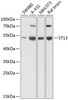 Western blot analysis of extracts of various cell lines, using ST13 antibody (23-595) at 1:1000 dilution.<br/>Secondary antibody: HRP Goat Anti-Rabbit IgG (H+L) at 1:10000 dilution.<br/>Lysates/proteins: 25ug per lane.<br/>Blocking buffer: 3% nonfat dry milk in TBST.<br/>Detection: ECL Basic Kit.<br/>Exposure time: 1s.
