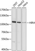 Western blot analysis of extracts of various cell lines, using HIRA antibody (23-599) at 1:1000 dilution.<br/>Secondary antibody: HRP Goat Anti-Rabbit IgG (H+L) at 1:10000 dilution.<br/>Lysates/proteins: 25ug per lane.<br/>Blocking buffer: 3% nonfat dry milk in TBST.<br/>Detection: ECL Basic Kit.<br/>Exposure time: 10s.