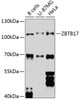 Western blot analysis of extracts of various cell lines, using ZBTB17 Antibody (23-600) at 1:1000 dilution.<br/>Secondary antibody: HRP Goat Anti-Rabbit IgG (H+L) at 1:10000 dilution.<br/>Lysates/proteins: 25ug per lane.<br/>Blocking buffer: 3% nonfat dry milk in TBST.<br/>Detection: ECL Basic Kit.<br/>Exposure time: 90s.