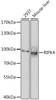 Western blot analysis of extracts of various cell lines, using RIPK4 antibody (23-623) at 1:1000 dilution.<br/>Secondary antibody: HRP Goat Anti-Rabbit IgG (H+L) at 1:10000 dilution.<br/>Lysates/proteins: 25ug per lane.<br/>Blocking buffer: 3% nonfat dry milk in TBST.<br/>Detection: ECL Enhanced Kit.<br/>Exposure time: 30s.