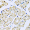 Immunohistochemistry of paraffin-embedded human stomach using SMEK1 antibody (23-626) at dilution of 1:100 (40x lens) .