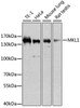 Western blot analysis of extracts of various cell lines, using MKL1 antibody (23-628) at 1:1000 dilution.<br/>Secondary antibody: HRP Goat Anti-Rabbit IgG (H+L) at 1:10000 dilution.<br/>Lysates/proteins: 25ug per lane.<br/>Blocking buffer: 3% nonfat dry milk in TBST.<br/>Detection: ECL Basic Kit.<br/>Exposure time: 10s.